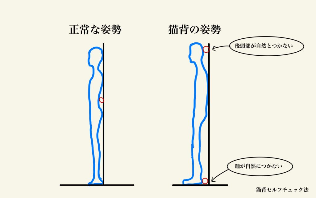 猫背のセルフチェック方法